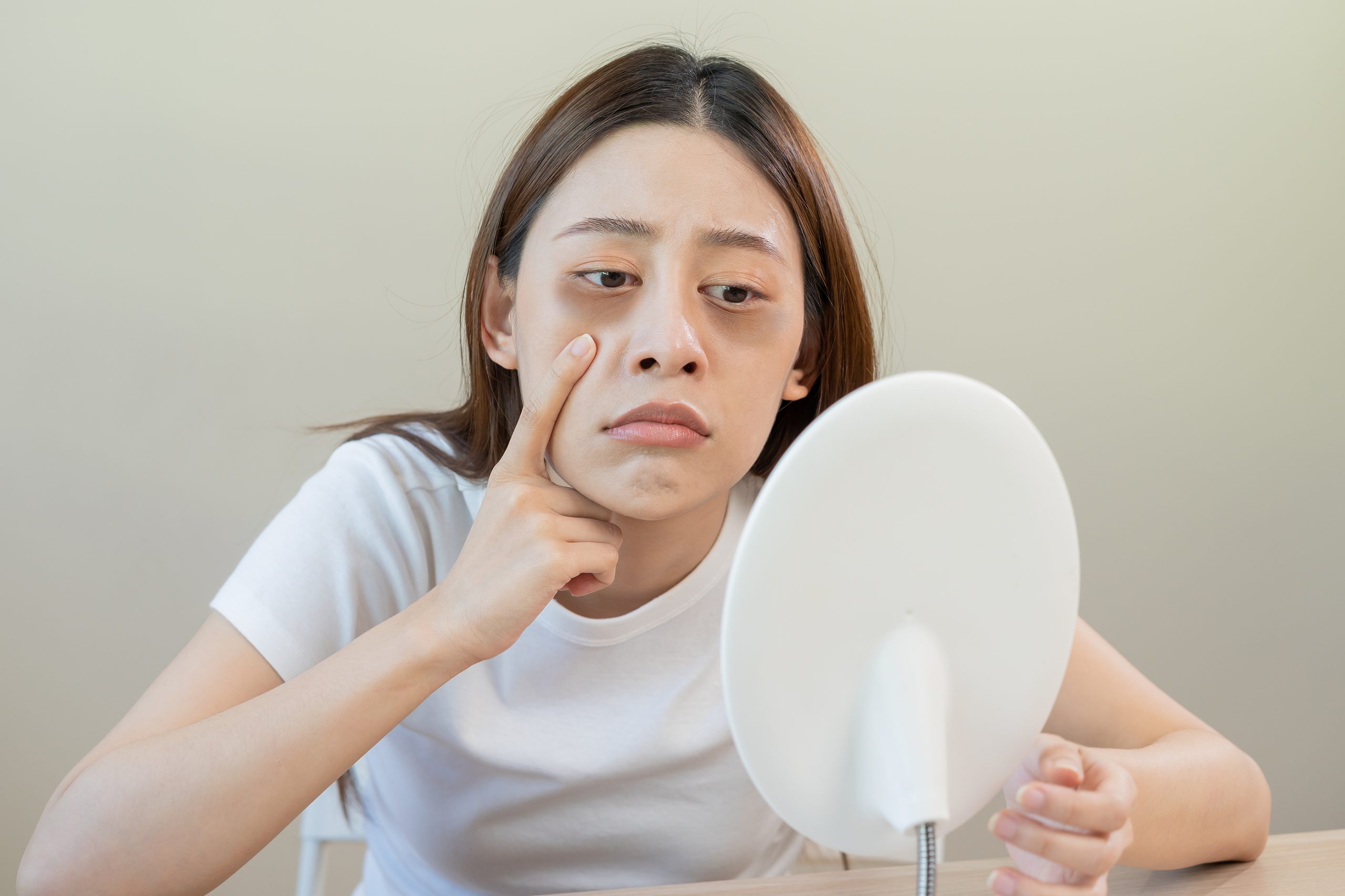 Can PRFM Help with Under-Eye Circles and Skin Tone?