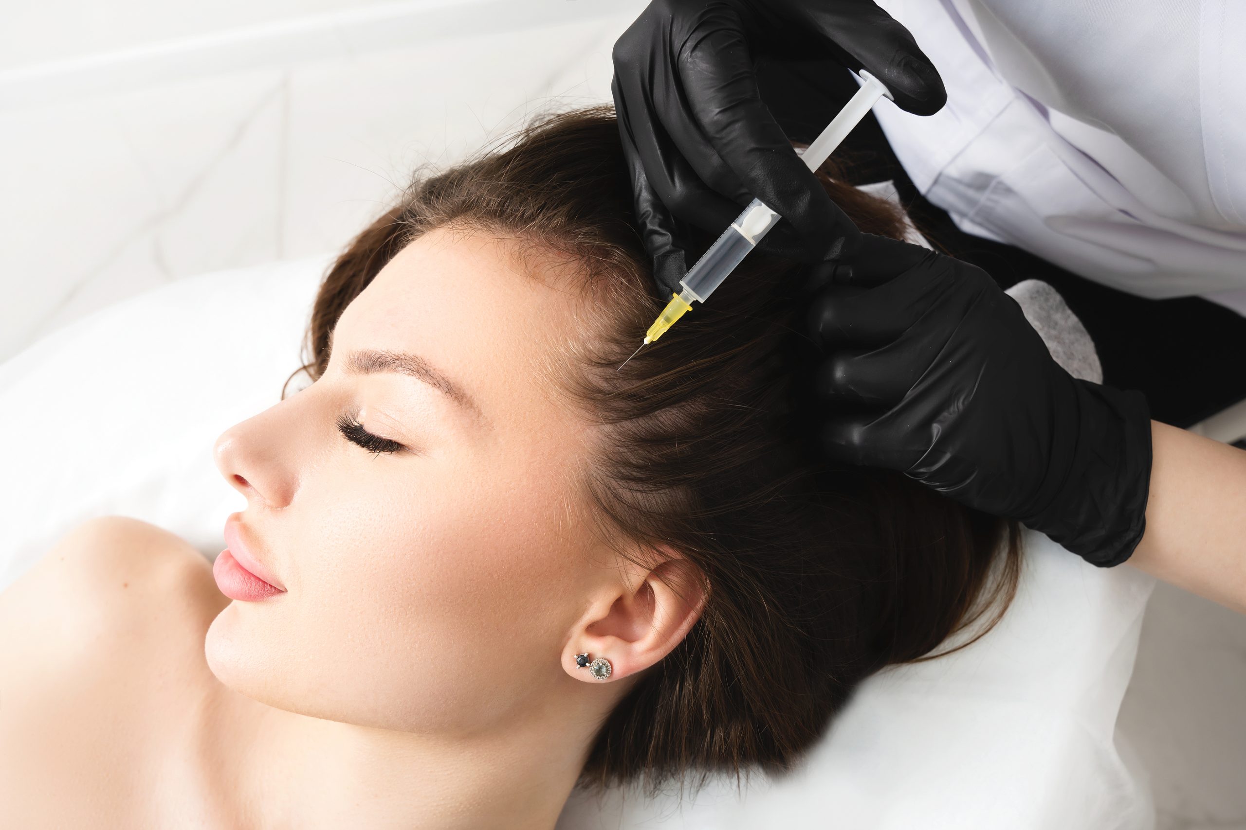 How PRP and PRFM Injections Support Hair Restoration