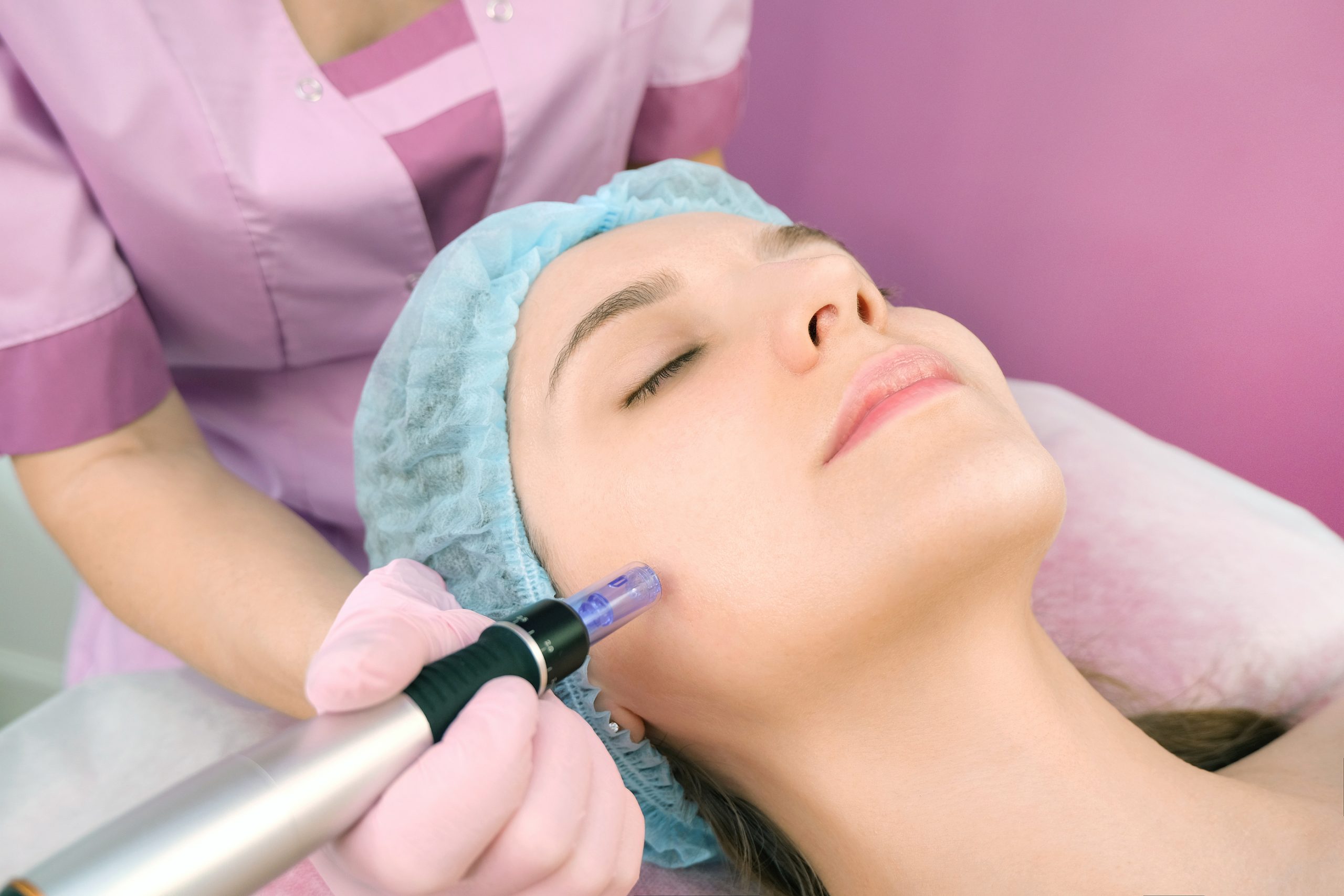 How PRP Microneedling Helps with Fine Lines and Wrinkles