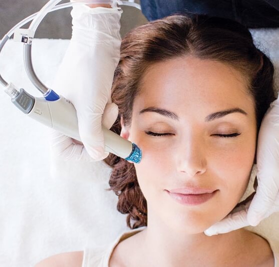 ALL ABOUT HYDRAFACIAL FOR ACNE SCARS